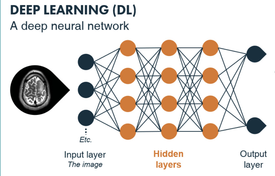 Deep Learning Image